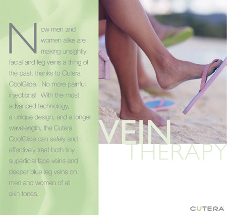 Laser Vein Treatment, Vein Therapy, Cutera CoolGlide Miami Beach Florida No Lines Med Spa Miami Beach, Nolines Med Spa Miami Beach Florida, No Lines Tanning Salon and MedSpa MedSpa Miami Beach